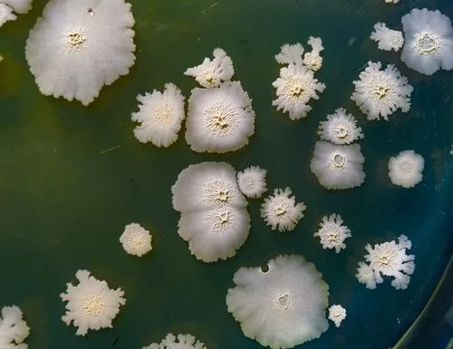 Common Types of Mold Found in Homes: What You Need to Know